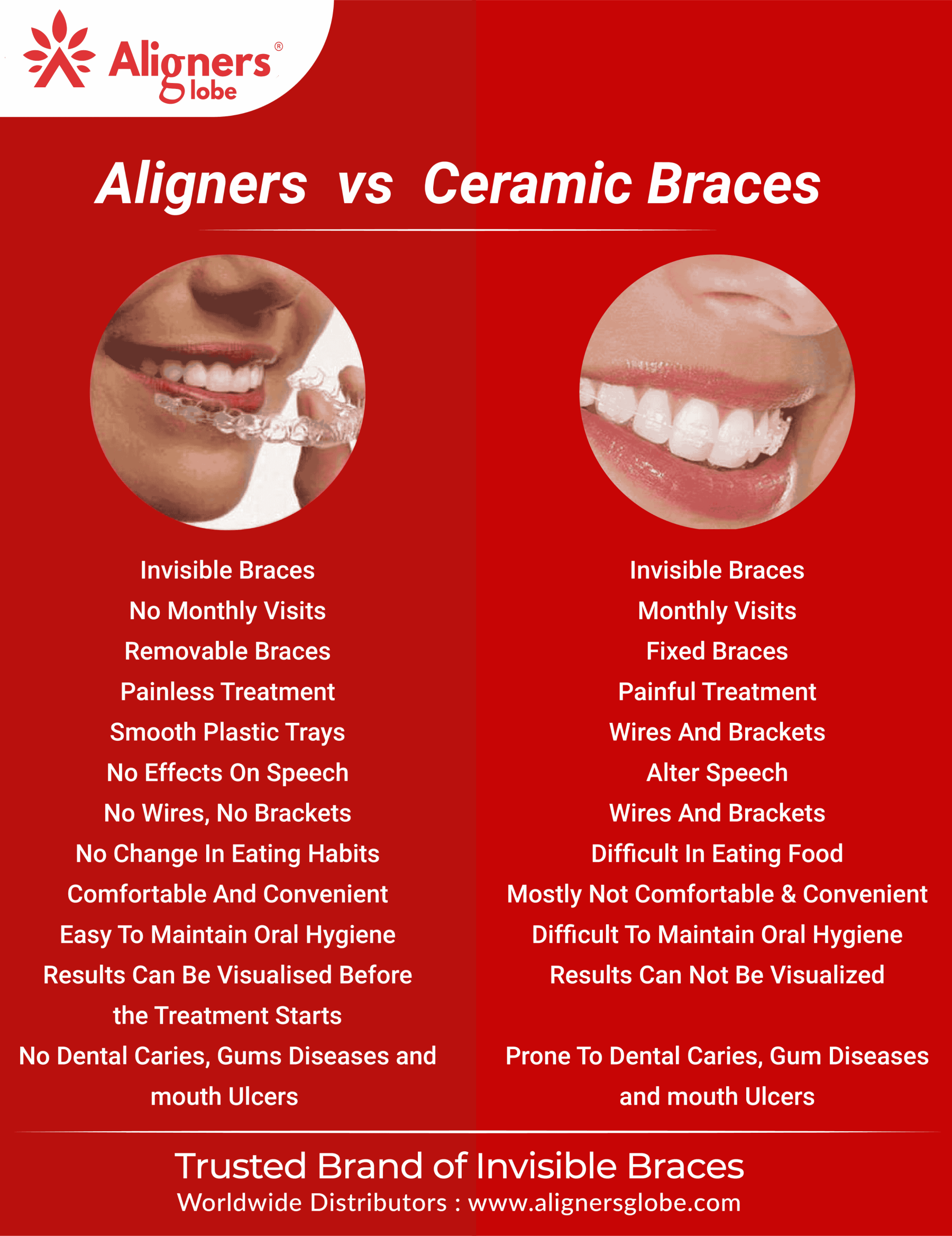 Comparison between Aligners and Ceramic braces